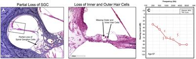 Inner ear therapeutics and the war on hearing loss: systemic barriers to success